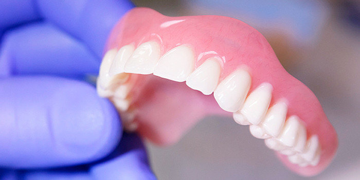 Съёмные зубные протезы, что это, их преимущества | сеть стоматологий  Экстродент